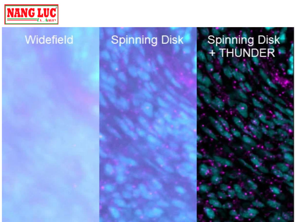 Kính Hiển Vi Quan Sát Tế Bào Đĩa Quay (Imager Cell Spinning Disk) Leica Model THUNDER Imager Cell Spinning Disk