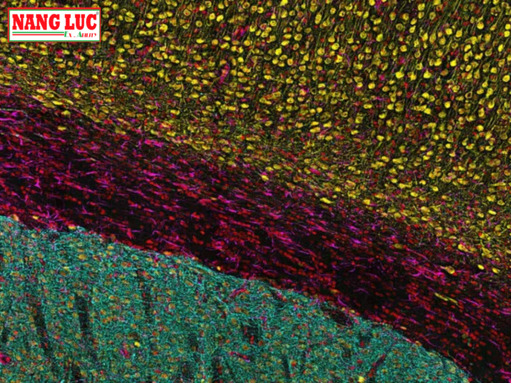 Kính Hiển Vi Quan Sát Tế Bào Đĩa Quay (Imager Cell Spinning Disk) Leica Model THUNDER Imager Cell Spinning Disk