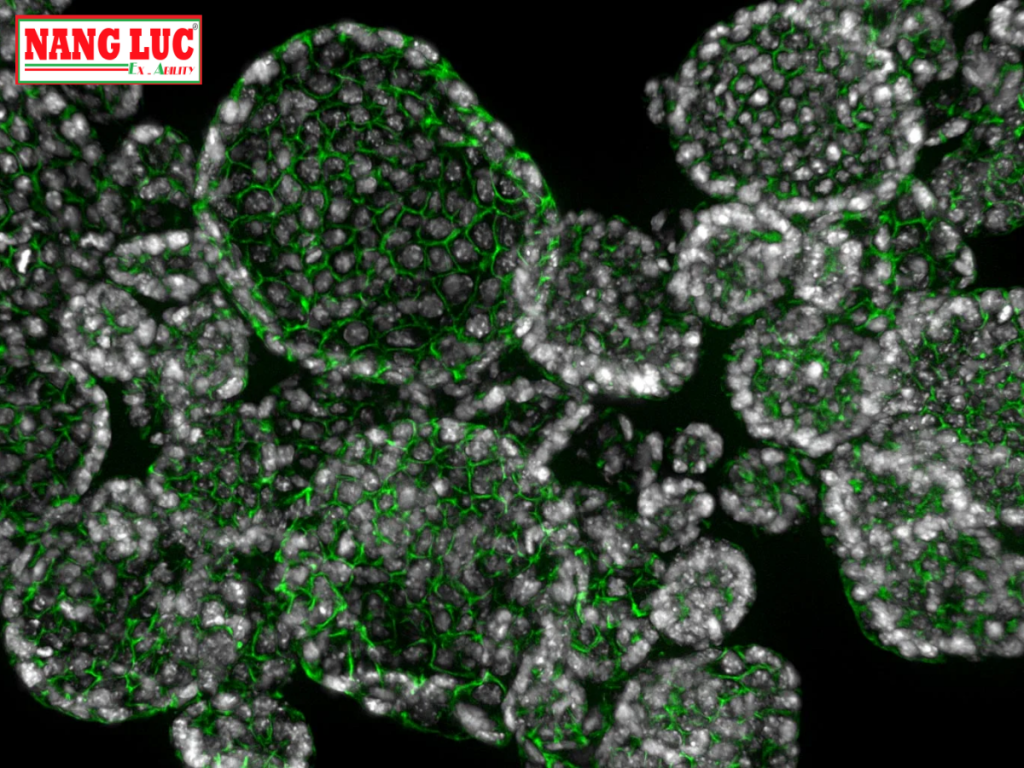 Kính Hiển Vi Quan Sát Tế Bào Sống và Thử Nghiệm 3D (Imager Live Cell & 3D Assay) Leica Model THUNDER Imager Live Cell & 3D Assay